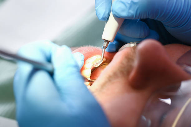 Best Urgent Tooth Repair  in Ocean Pines, MD