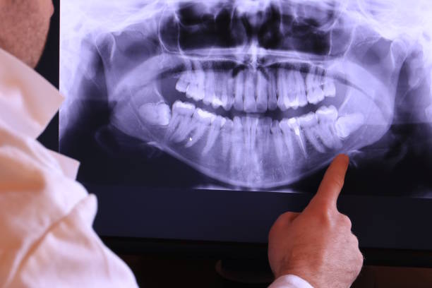 Best Chipped Tooth Repair Near Me  in Ocean Pines, MD